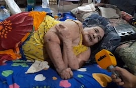 Doña Tomasa Vargas, quien lleva un año y siete meses postrada en cama.