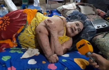 Doña Tomasa Vargas, quien lleva un año y siete meses postrada en cama.