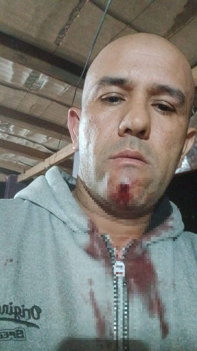 Candidato a concejal colorado con expresión tranquila, vestido casual, rodeado por un ambiente de incertidumbre en una escena pública nocturna.