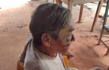 La víctima de la brutal golpiza se encuentra en proceso de recuperación en la casa de su madre ubicada en la colonia Luz Bella.