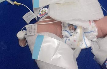 El pequeño no tiene movilidad en el brazo izquierdo, denuncian los padres.