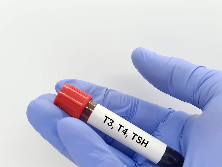 Mano con guante azul sostiene un tubo de ensayo con tapón rojo y etiqueta de T3, T4, TSH en un ambiente limpio.
