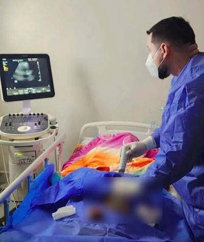 Realizaron la segunda biopsia renal que fue guiada por ecografía en el Hospital Regional de Caacupé.