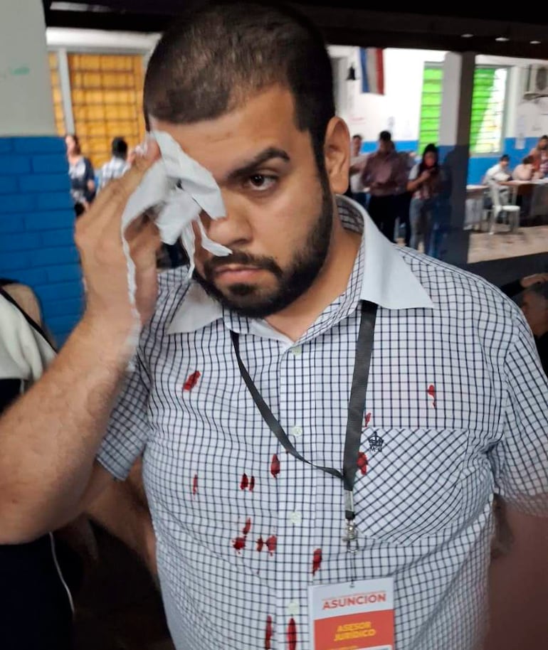 Hombre con camiseta de cuadros y herida en la frente, usando un papel para limpiarla, con expresión seria.