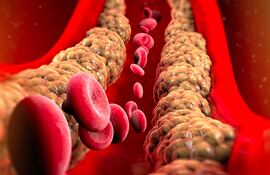 Un grupo de científicos de Viena ha hallado evidencias de que los fármacos clásicos para reducir el colesterol, las estatinas, tienen también un efecto secundario positivo al “matar células vasculares envejecidas”.