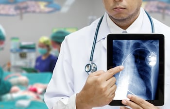 Concepto de marcapasos.