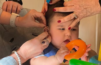 Luan Mateo Benítez Amarilla. El nació el 7 de abril de 2025 y, desde sus primeras semanas de vida, presentó resultados negativos en los estudios de otoemisiones acústicas realizados en distintos momentos y centros médicos. Posteriormente, se confirmó su diagnóstico de hipoacusia bilateral profunda (sordera).
Tras consultas con especialistas en otorrinolaringología y fonoaudiología, se dio inicio a un seguimiento interdisciplinario y a estudios complementarios. En noviembre del año pasado recibió dos audífonos gracias a la Fundación Florencia, y actualmente realiza sesiones semanales de terapia de estimulación auditiva, como parte de la preparación previa, dado que es candidato a una cirugía de implante coclear.