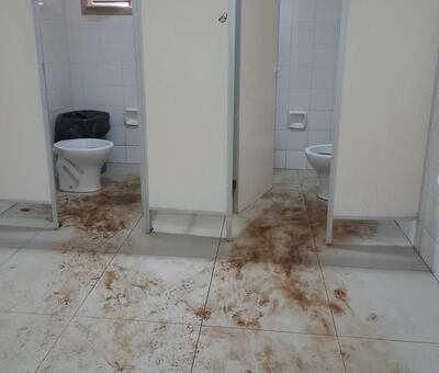 Denuncian que hace seis meses el sanitario de mujeres está inhabilitado en el Hospital Regional de Caacupé