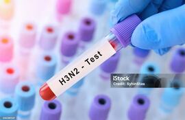 Test de H3N2