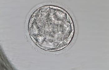 Blastocisto.
