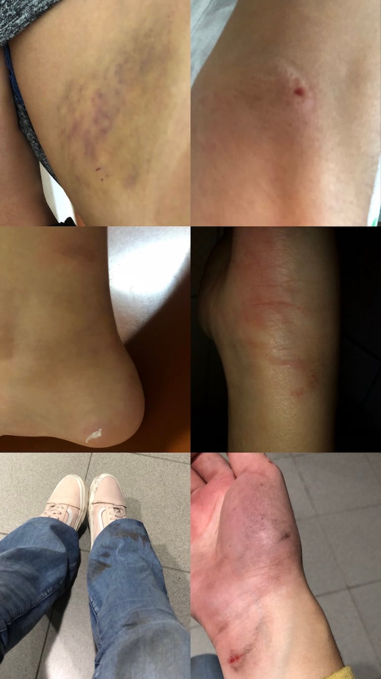 Las lesiones que sufrió la joven tras lanzarse del vehículo que había solicitado por medio de la plataforma Bolt.