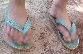 El grave caso salió a luz cuando vecinos denunciaron violación del deber del cuidado con relación a una niña con los pies y manos cubiertos de piques.