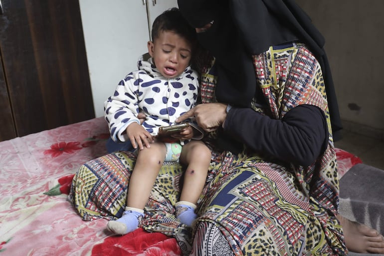 El bebé gazatí Jawad conoce a su corta edad lo que implica vivir bajo una ocupación militar: disparos del Ejército israelí, la detención de su padre y la suya y, según el relato de familiares y documentos médicos, el maltrato físico a manos de soldados.
