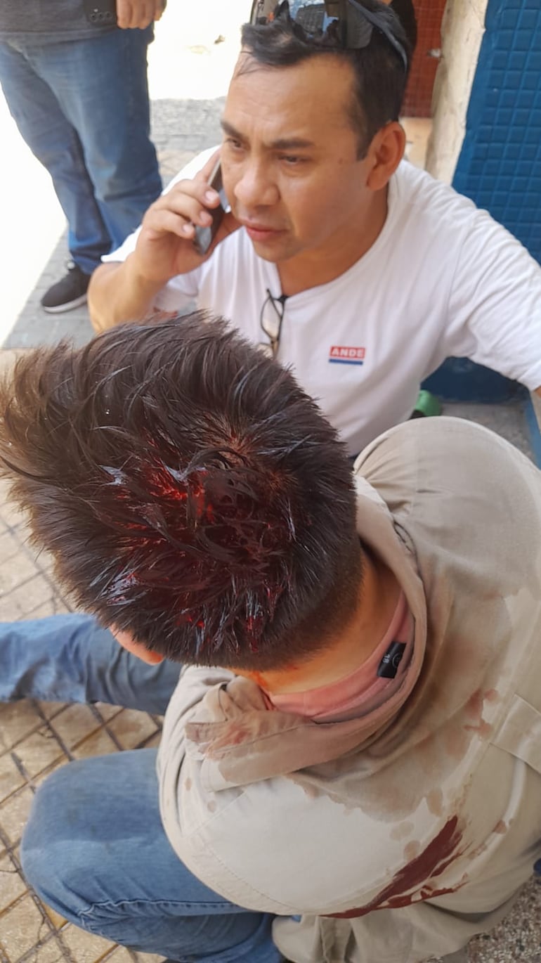 Guillermo Gill, funcionario de la ANDE herido en los incidentes en los alrededores del Congreso, durante las protestas contra el tratamiento de la ley que crea la Superintendencia de Jubilaciones.