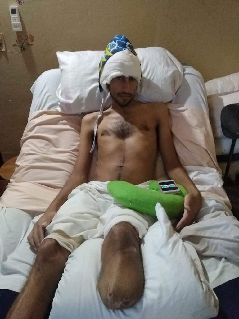 Joven sin camiseta en cama de hospital, con vendajes en cabeza y extremidades, con expresión seria y cojín verde junto a él.