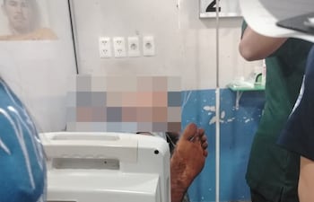 El supuesto agresor quedó internado bajo custodia en el Hospital Regional de Ciudad del Este.