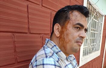 Darío Giménez, periodista agredido durante allanamientos a Municipalidad de Jesús.