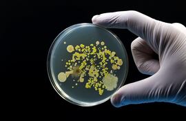 Un cultivo microbiológico de Petri con bacterias