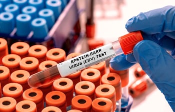 Tubos de prueba del virus de Epstein-Barr, imagen ilustrativa.