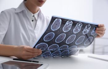 Un médico examina imágenes de un cerebro