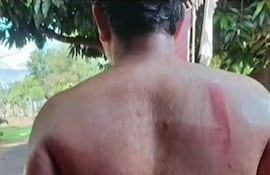 Uno de los alumnos quedó con varias marcas a raíz del castigo físico.