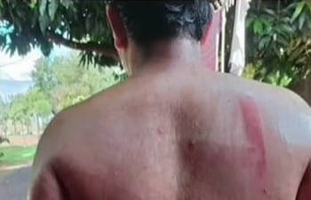 Uno de los alumnos quedó con varias marcas a raíz del castigo físico.