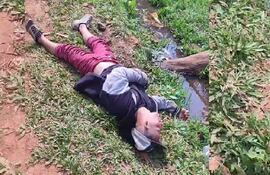 Celso Daniel Chaparro Sosa, herido con balines de goma.