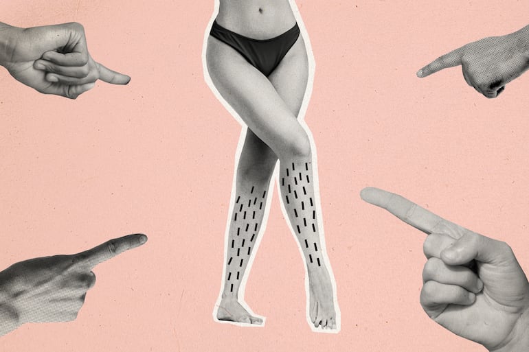 Concepto de body shaming en redes sociales.