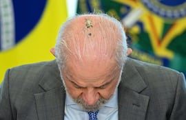 Imagen de archivo: Lula comenzó un tratamiento de radioterapia preventiva el 25 de mayo de 2026, tras someterse a una cirugía el mes pasado por una lesión en el cuero cabelludo, según informó el hospital donde se realizó el procedimiento.