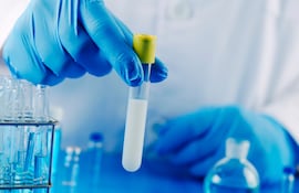 Vivir acelerado y dormir poco no solo afecta el ánimo: también puede alterar hormonas, inflamación y temperatura corporal, variables que influyen en la concentración y movilidad de los espermatozoides.