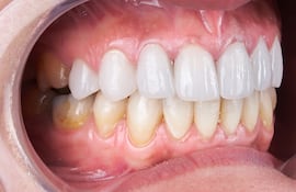 ¿Qué dice el color de tus dientes sobre tu salud?