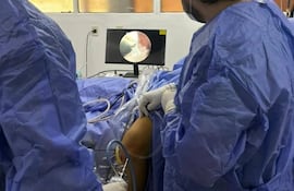 Desarrollaron con éxito la primera cirugía por vía artroscópica en el Hospital Regional de Caacupé.