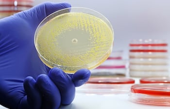Concepto de infecciones bacterianas resistentes a los antibióticos.