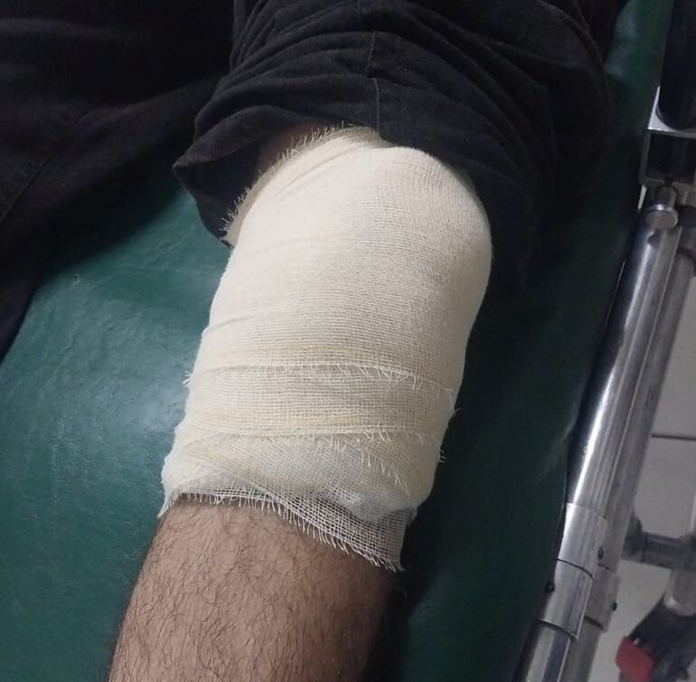 Una de las víctimas sufrió una herida de bala en una de sus rodillas.