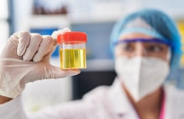 Cuando estamos sanos e hidratados, la orina debe tener un color entre incoloro, claro o miel. Cuando no consumimos suficientes líquidos, la orina se vuelve más concentrada y adquiere un color amarillo más oscuro o ámbar.
