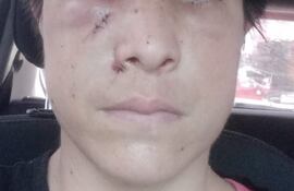 Una mujer, Paola Ozuna, denunció que fue atacada brutalmente en el microcentro de Asunción
