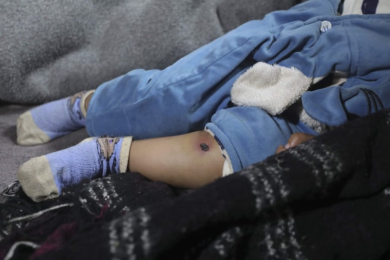 El bebé gazatí Jawad conoce a su corta edad lo que implica vivir bajo una ocupación militar: disparos del Ejército israelí, la detención de su padre y la suya y, según el relato de familiares y documentos médicos, el maltrato físico a manos de soldados.
