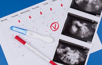 Concepto de fertilidad.