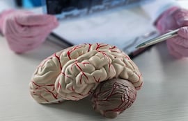 Médico analiza un estudio de una persona con esclerosis múltiple.