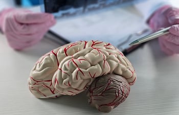 Médico analiza un estudio de una persona con esclerosis múltiple.