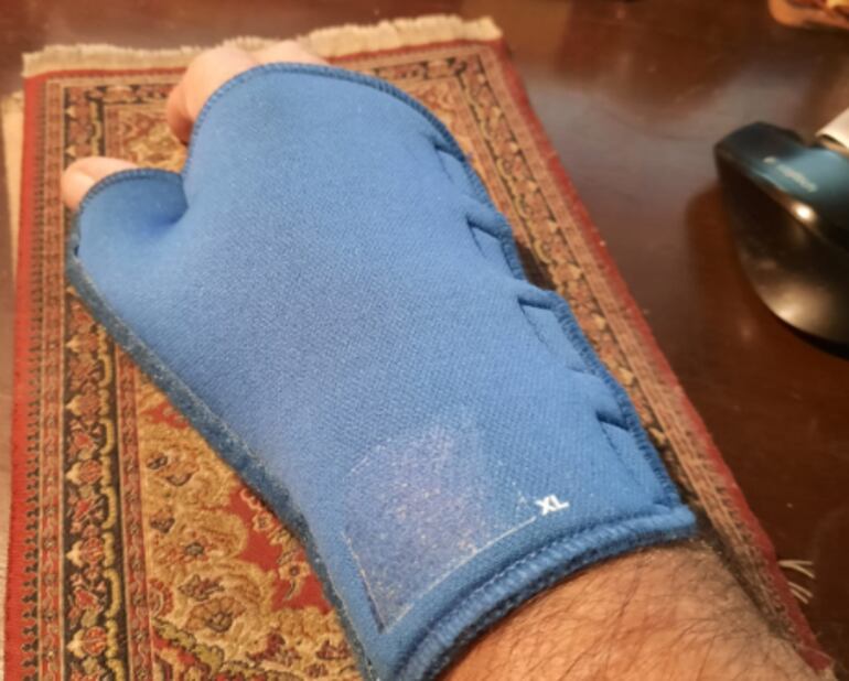 Muñeca con luxación, del denunciante.