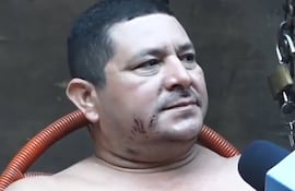 Derlis Toledo (42) quedó con múltiples heridas a lo largo de su cuerpo tras el ataque de los perros.