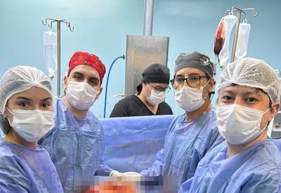 Cinco personas en quirófano, incluyendo un hombre con gorro rojo y tres hombres con gorros grises y negro, sosteniendo órgano extraído.