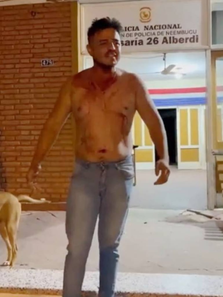 Diego Orlando Vargas Villalba, aún sangrando, frente a la comisaría de Alberdi tras el violento asalto que sufrieron el 27 de enero de 2025.