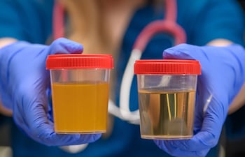 Cómo saber si estás bebiendo suficiente agua según el tono de tu orina.