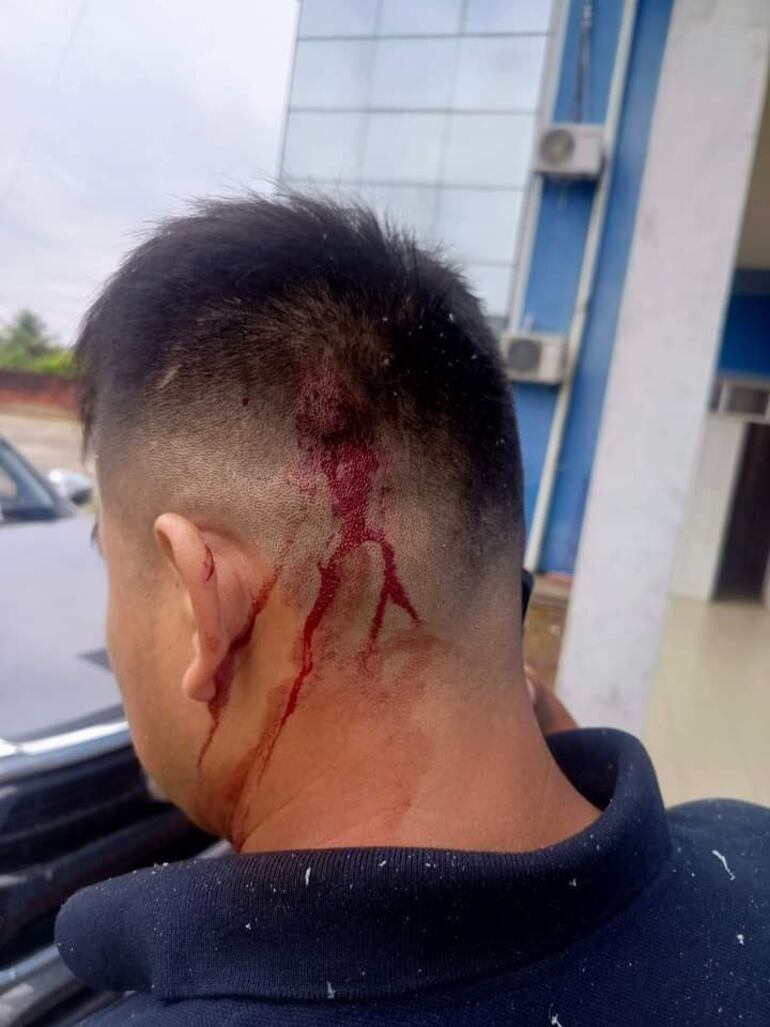 Imagen del chofer del expresidente Evo Morales después de un supuesto ataque armado contra el vehículo del exmandatario, este domingo en Cochabamba (Bolivia). 