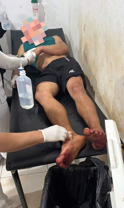 Joven atacó con cuchillo y cercenó un dedo a un adolescente en Paso Yobái.