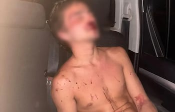 Martín Vera Articanaba (27) denunció ser agredido brutalmente tras un accidente de tránsito.