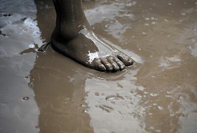 /pf/resources/images/abc-placeholder.png?d=2377