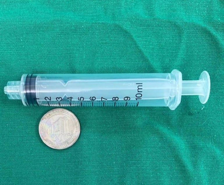 La moneda de 500 guaraníes que fue extraída del cuerpo de un niño de tres años.